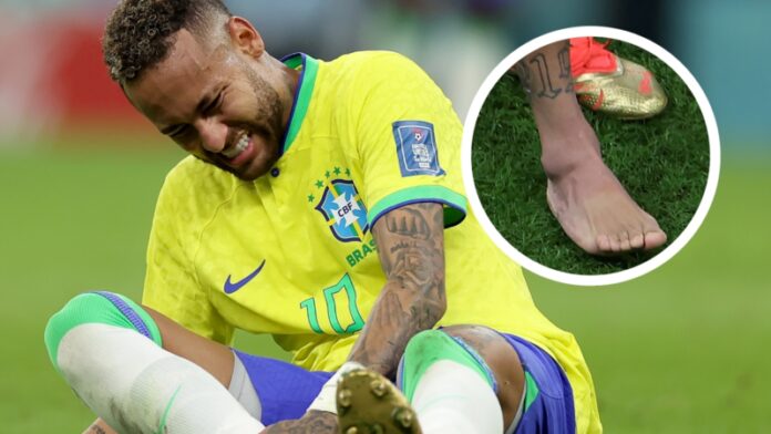 Neymar revela estado de sua lesão (Foto: Getty/GOAL)